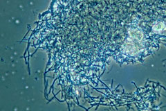 Lactobacillus sp