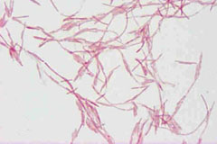 Fusobacterium＿nucleatum